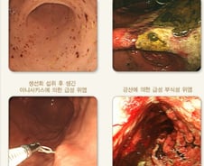 "그냥 숙취인 줄 알았는데"...당장 병원 가야 할 복통 신호