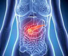 구멍 1개만 뚫는 '이 수술법', 췌장 머리 종양 없앤 후 통증·감염 ↓