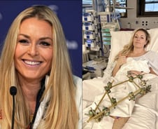 '美스키 여제' 린지 본, 올림픽 부상 뒤 세 번째 수술..."성공의 의미 달라져"