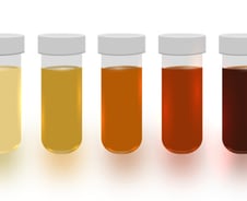 소변 보고 오더니 '노랗게' 질렸다...색깔로 보는 건강 상태 [한 장으로 보는 건강]