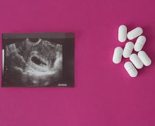"자궁에서 피 쏟아진다" 사망할 수도...속도 내는 '낙태법', 의사들은 경고