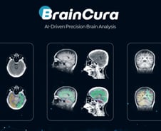 "MRI 긴 대기 시간 줄인다"…뉴블에이아이, 4억 시드투자 유치