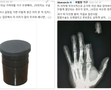 드럼통 의자에 손가락 절단…"얼음물에 바로 담갔다간 큰일"[한 장으로 보는 건강]