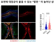 "방광염 나은 듯 하더니 또"...재발 잦은 이유 찾았다[한 장으로 보는 건강]