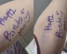 생일날 암 수술을?…"마취 깨면 보도록" 의사 '감동' 메시지[오따뉴]