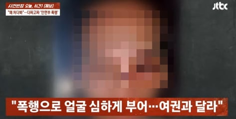"한국인 남성들이 집단폭행" 코뼈 골절, 시력 뚝...필리핀서 무슨 일