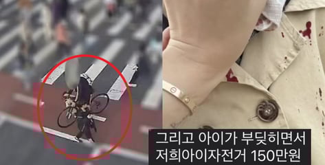 횡단보도서 5살아이 친 중학생…"학생 엄마는 자전거 비싼건데 기스 나" 황당