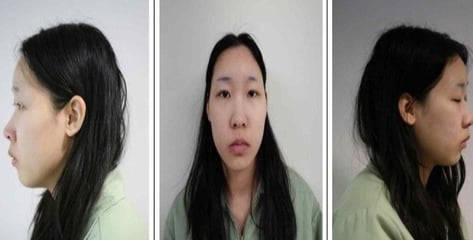 "나도 당했다" 모텔 연쇄살인 김소영 피해자 총 6명…추가 기소