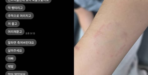 "아빠, 제발 살려줘요" SOS...바지 벗겨진 딸, 학폭에 얼굴 퉁퉁