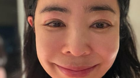 '폐암 수술' 이혜영, 후유증에 눈 퉁퉁..."건강 회복이 목표"