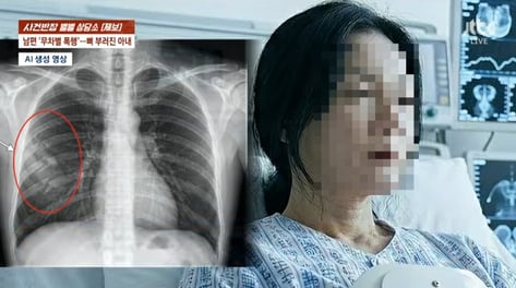 자녀 앞에선 다정한데..."시부모 제사를 잊어?" 남편 폭행에 갈비뼈 골절