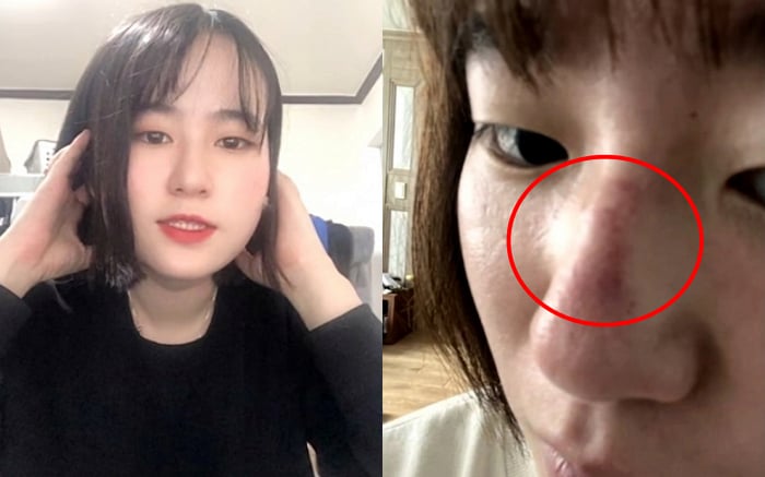 "목 잡아 올리고 엉덩이 걷어차" 여직원 숨졌는데...직장 상사 "장난"