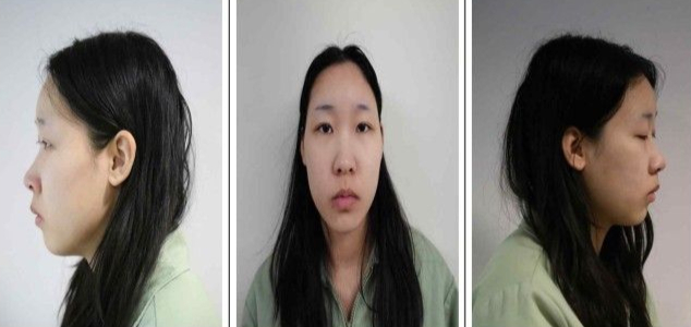 "나도 당했다" 모텔 연쇄살인 김소영 피해자 총 6명…추가 기소